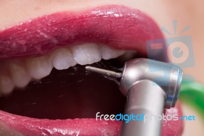 Dentist Curing A Female Patient Stock Photo