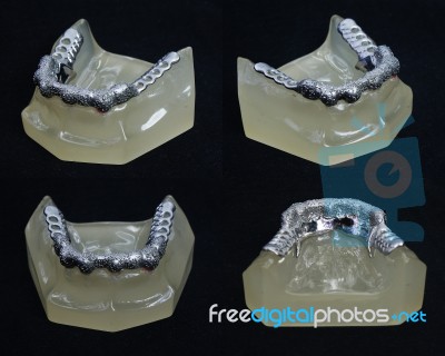 Dentures Stock Photo