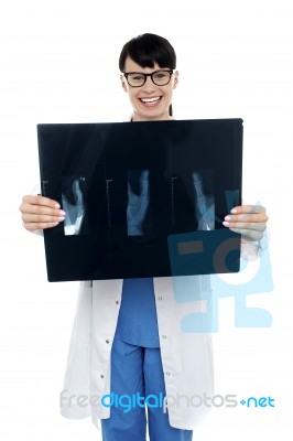 Doctor Displaying X-ray Report Of Thumb Finger Stock Photo