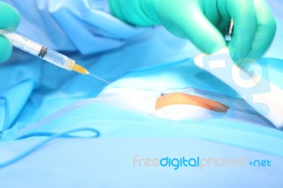 Doctor Putting Anesthesia In An Open Wound.  Focus In The Open W… Stock Photo