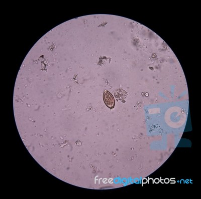 Egg Parasite Stock Photo