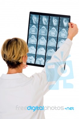 Examining X-Rays Stock Photo