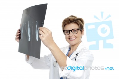 Experienced Female Doctor Examining X-ray Report Stock Photo