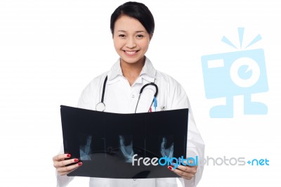 Female Doctor Analyzing Patient's X-ray Stock Photo