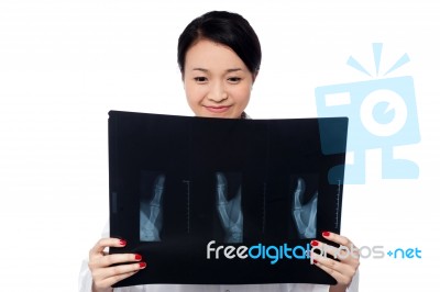 Female Doctor Analyzing Patient's X-ray Report Stock Photo