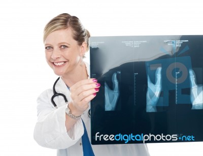 Female Doctor Holding X Ray Report Stock Photo