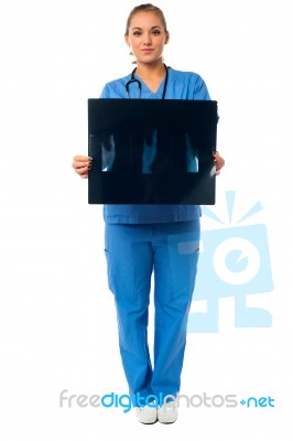 Female Doctor With X-ray Report Stock Photo