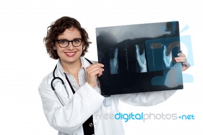 Female Surgeon Holding Up X-ray Sheet Stock Photo