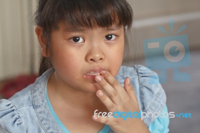 Girl Toothache Stock Photo