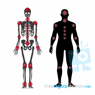 Human Body With Area Of Pain Stock Image