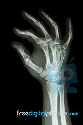 Human's Hand And Ok Symbol Stock Photo