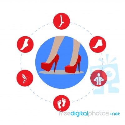 Infografics Woman: High Heels And Our Disease. Illustration Stock Image