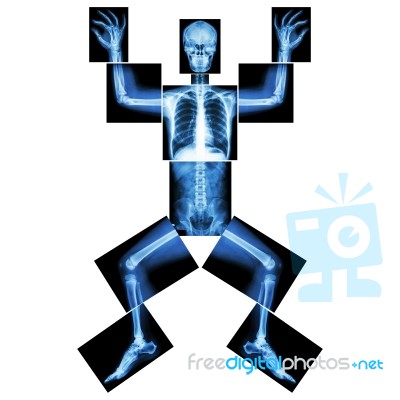 Jigsaw Human X-ray ( Whole Body : Head Skull Face Neck Spine Shoulder Arm Elbow Joint Forearm Wrist Hand Finger Chest Thorax Heart Lung Rib Abdomen Back Pelvis Hip Thigh Knee Leg Ankle Foot Heel Toe ) Stock Photo