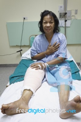 Knee Replacement Incision Stock Photo