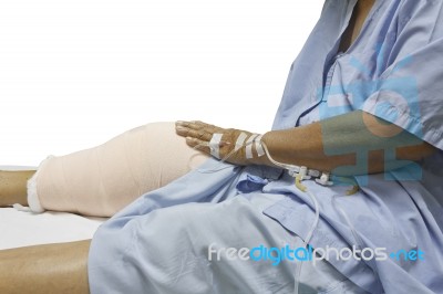 Knee Replacement Incision Stock Photo