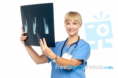 Lady Surgeon Holding Up X-ray Report Stock Photo