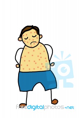 Little Boy Is Sick With Chickenpox Stock Image