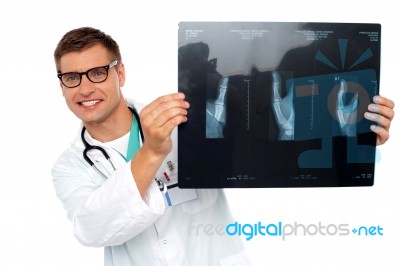 Male Doctor Behind X Ray Report Stock Photo