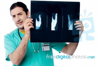 Male Doctor Observing X Ray Image Stock Photo