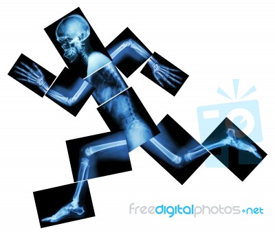 Marathon (human Bone Is Running) ,(whole Body X-ray : Head ,neck ,shoulder ,arm ,elbow ,forearm ,hand ,finger ,joint ,thorax ,abdomen ,back,pelvis ,hip ,thigh ,leg ,knee ,foot ,heel) Stock Photo