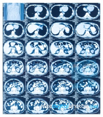 Medical Diagnosis Background. Ct Scan Stock Photo