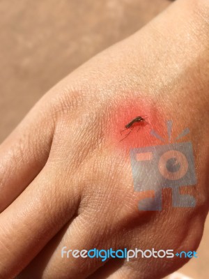 Mosquito Sucking Blood On Human Skin With Red Spot Stock Photo