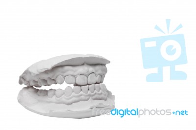 Mould Of Human Teeth Stock Photo