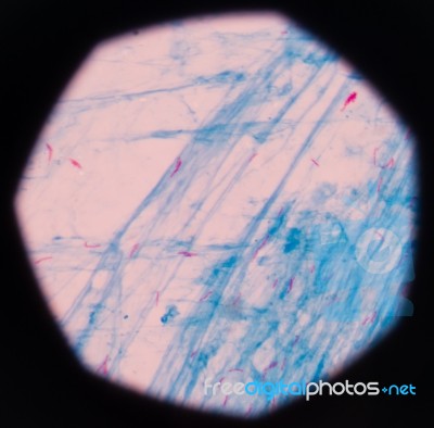 Mycobacterium Tuberculosis Red Cells On Blue Background Stock Photo