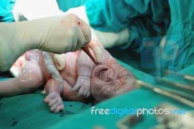 New Born Infant In The Operation Room Stock Photo