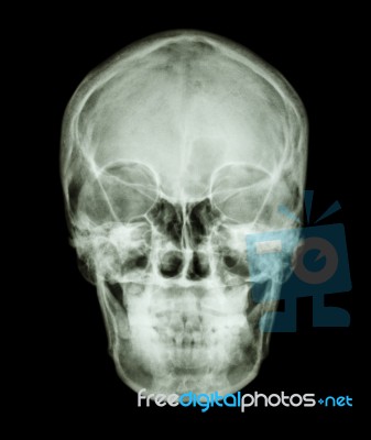 Normal Asian Human's Skull (thai People) Stock Photo