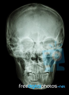 Normal Human Skull Stock Photo