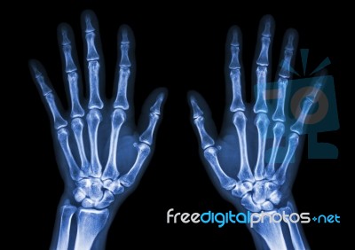 Normal Human's Hands Stock Photo