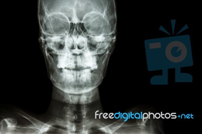 Normal Human's Skull And Blank Area At Right Side Stock Photo