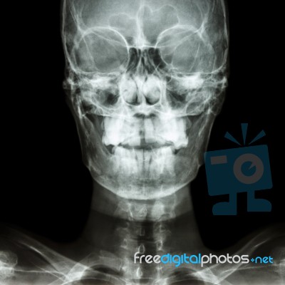 Normal Human's Skull And Blank Area At Right Side Stock Photo