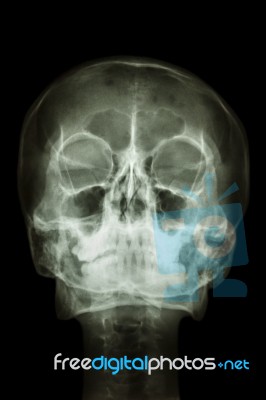 Normal Human's Skull And Cervical Spine Stock Photo