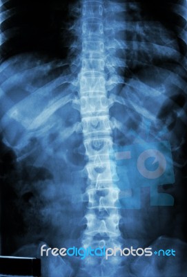 Normal Human's Thoracic-lumbar Spine Stock Photo