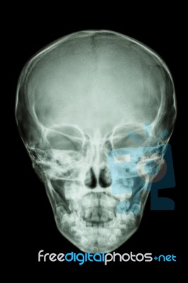 Normal Thai Child's Skull Stock Photo