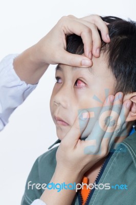 Pinkeye (conjunctivitis) Infection On A Boy, Doctor Check Up Eye… Stock Photo