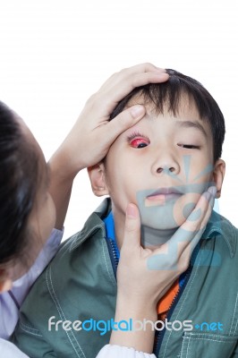 Pinkeye (conjunctivitis) Infection On A Boy, Doctor Check Up Eye Patient. Studio Shot Stock Photo