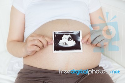 Pregnant Belly With Ultrasound Photo Stock Photo