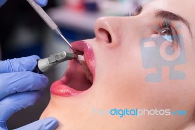 Professional Dental Brushing Stock Photo