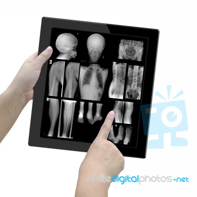 Radiology Stock Image