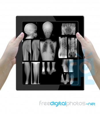 Radiology Stock Image