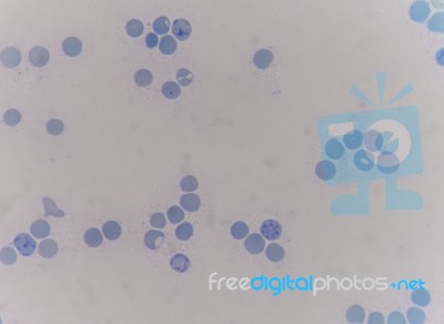 Reticulocyte Stock Photo