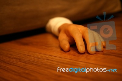 Severed Arm Stock Photo