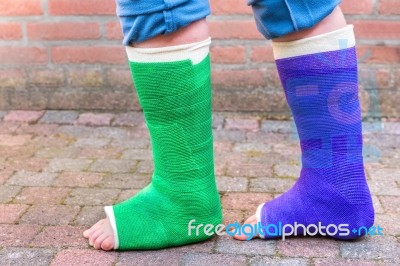 Standing Child With Two Colorful Gypsum Legs Stock Photo