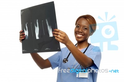 Surgeon Doctor Showing X Ray Stock Photo