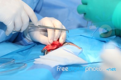 Surgery On A Lung Of An Infant Stock Photo