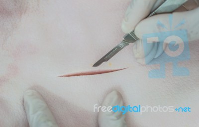 Suture Skin Stock Photo