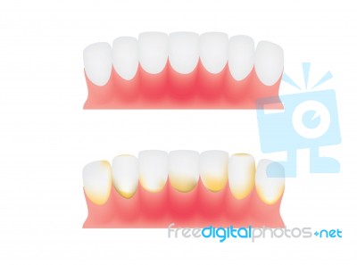 Teeth And Gums Stock Image